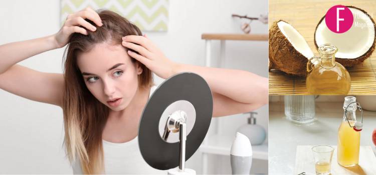 Hair Care 101: Hair Fall Or Bald Spots? Try These Home Remedies Now!